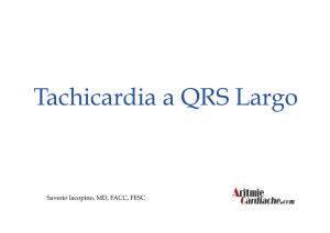 Tachicardia a QRS Largo