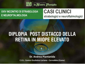 Diplopia post distacco della retina in miope elevato
