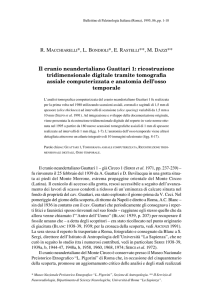 Il cranio neandertaliano Guattari 1: ricostruzione