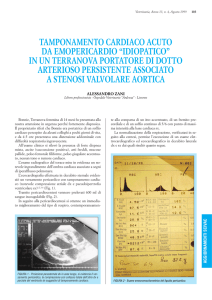 tamponamento cardiaco acuto da emopericardio