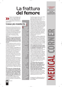 La frattura del femore