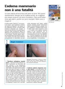 L`edema mammario non è una fatalità - Ex