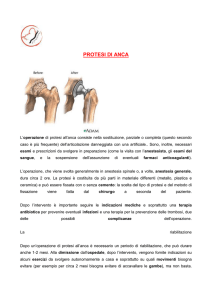 La protesi d anca - Sito di fisioterapia e salute