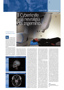 Il Cyberknife e la nevralgia del trigemino