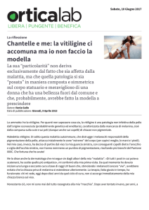 Chantelle e me: la vitiligine ci accomuna ma io non faccio la modella