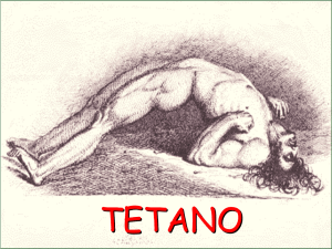 TETANO File - Progetto e