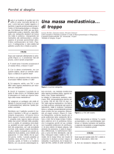 Una massa mediastinica... di troppo