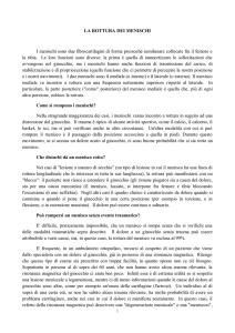 La rottura dei menischi