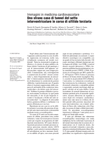 Immagini in medicina cardiovascolare Uno strano caso di tunnel del