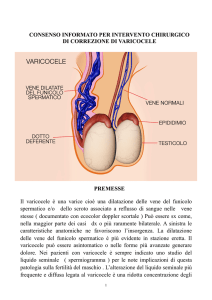 consenso intervento per varicocele 2016