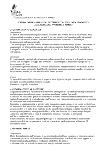 Consenso informato