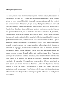 Cheilognatopalatoschisi La schisi palatina è una