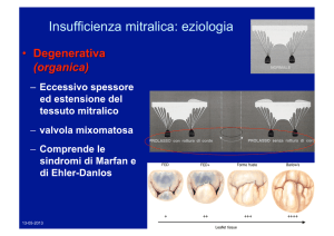 Insufficienza mitralica: eziologia