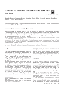 Metastasi da carcinoma neuroendocrino della cute