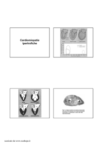 Cardiomiopatie