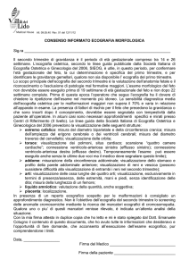Consenso informato