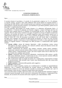 Consenso informato