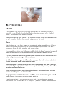 Ipertiroidismo