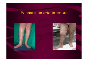 Edema a un arto inferiore