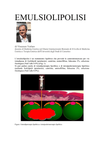 emulsiolipolisi - Medicina Estetica Italia