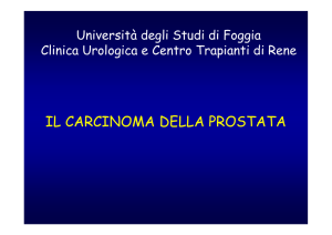 prostate cancer