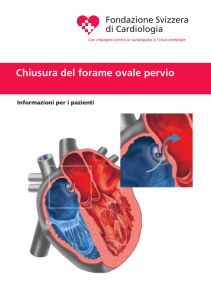 Chiusura del forame ovale pervio