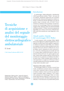Tecniche di acquisizione e analisi del segnale del monitoraggio