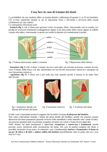 Cosa fare in caso di trauma dei denti