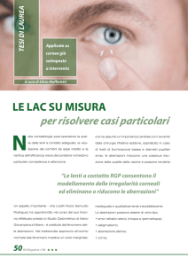 Le lac su misura per risolvere casi particolari
