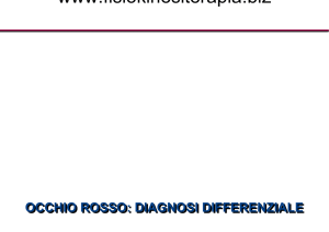 congiuntivite iridociclite glaucoma ac