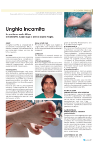 Unghia incarnita