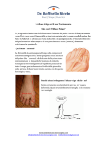 L`Alluce Valgo ed il suo Trattamento Che cos`è l`Alluce Valgo?