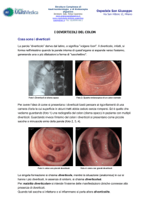 Diverticoli e complicanze (agg. 2012)