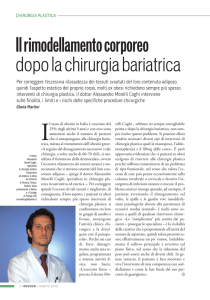 Il rimodellamento corporeo dopo la chirurgia bariatrica